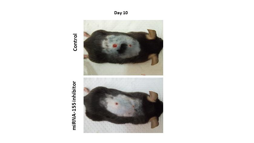Exciting new wound-healing study shows promising results -